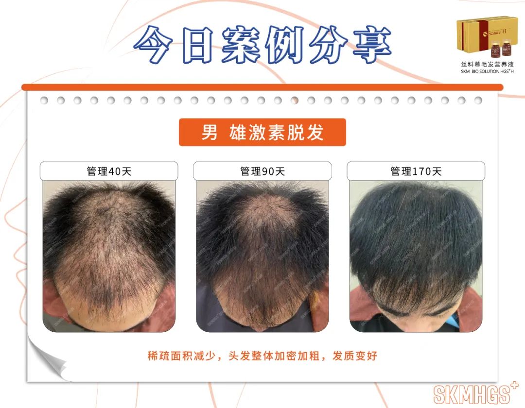 氨基酸液营养健身功效_氨基酸液营养健身的作用_健身氨基酸营养液